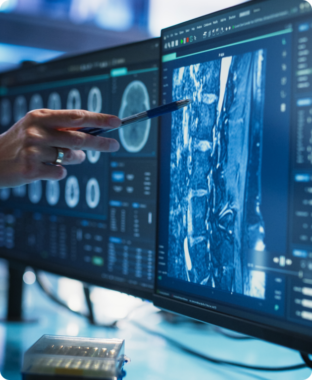 A tomografia computadorizada (TC) é uma técnica que revolucionou a forma como os profissionais de saúde veem o interior do corpo humano. Essa tecnologia avançada fornece imagens detalhadas em cortes transversais, sem sobreposição de estruturas.