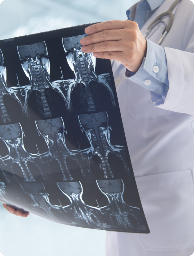 Quando a tomografia computadorizada é recomendada?